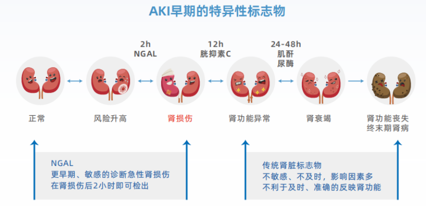 NGAL：中文名記不住，要記住這些臨床價值