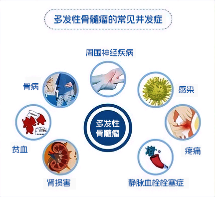 M蛋白上演消失的她？——淺談多發(fā)性骨髓瘤的診斷與療效評估